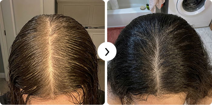 Håråterväxt före och efter