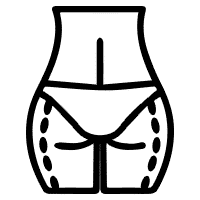 VANLIGA FRÅGOR